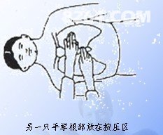 急救心肺复苏考试操作流程 142911ghfmlmlzdgzds5l5.jpg!t3w825h0