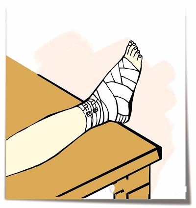 [壹陆户外干货讲堂]户外崴脚扭伤急救手册